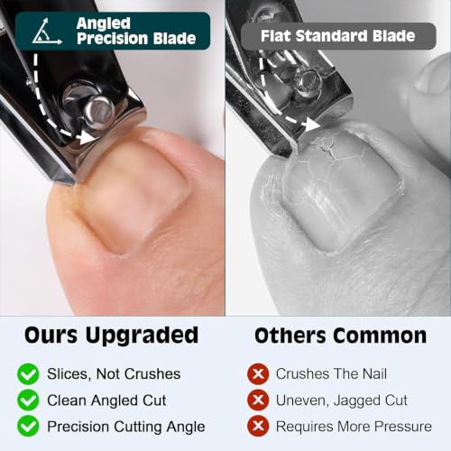 Image of Upgraded 20% Ultra Sharper All-in-One Fingernail and Toenail Clippers, 15% Thicker Sturdy DE-420J2 Stainless Steel, Great Gifts Nail Clippers for Seniors Toe Nail Clippers Case (3-in-1 Black)