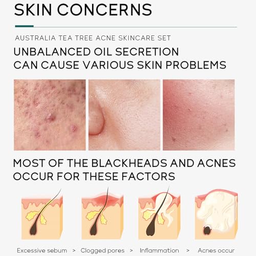 Tea Tree Skincare Set Gifts For Women & Men, Acne Treatment Tea Tree Oil Spot And Blackheads Remover Includes-Cleaner,Face Serum, Acne Gel,Toner,moisturiser For Acne Removal Oil Control - Image 5