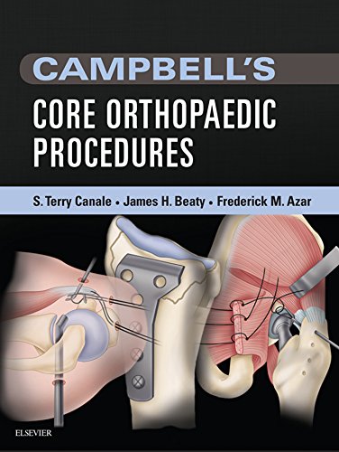 Télécharger Campbell's Core Orthopaedic Procedures (English Edition) Francais PDF