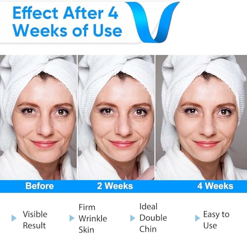 Aileda V Face Massaggiatore Viso,Antirughe Lifting Tonificante,Elettrica Doppio Mento Riduttore Massaggiatore Viso Lifting - 6