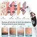 Blackhead Remover Pore Vacuum for Face & Nose – Deep Cleansing Blackhead Remover Tools with 3 Suction Levels, 5 Replaceable Tips, USB Rechargeable Pore Cleaner
