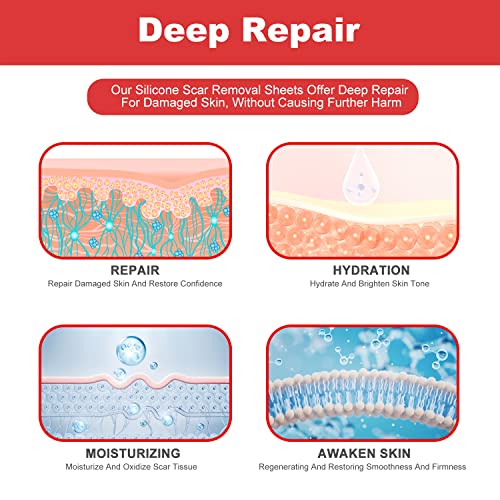FRESINIDER Silicone Scar Sheets - 5.9\"x2.4\" Extra-Large for Enhanced Coverage, Pack of 8 - Comfortable, Effective for Acne, Post-Surgery Scars, Hypertrophic, Keloid, Tummy Tucks