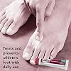 Tinactin Athlete's Foot Cream, Tolnaftate 1%, Antifungal, AF Treatment, Proven Clinically Effective on Most Athletes Foot and Ringworm, Cream, 0.5 Ounce, 15 Grams, Tube
