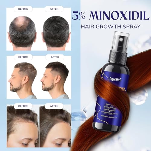 Image of 5% Minoxidil Hair Growth for Men and Women: 3-Pack RootStim Extra Strength Minoxidil with Rosemary for Thinning Hair Regrowth and Fuller Hair 180 ML