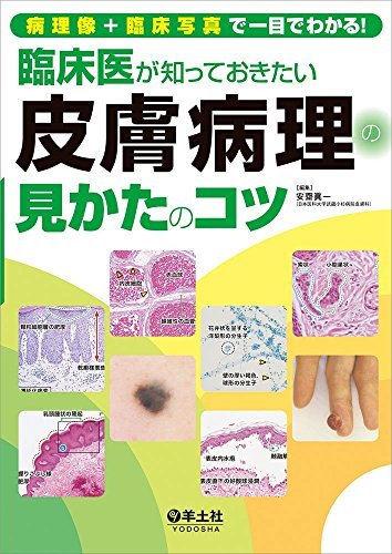 無料電子書籍 おすすめ 病理像+臨床写真で一目でわかる! 臨床医が知っておきたい皮膚病理の見か バイ