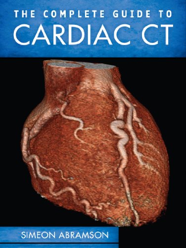 The Complete Guide to Cardiac CT The Complete Guide to Cardiac CT