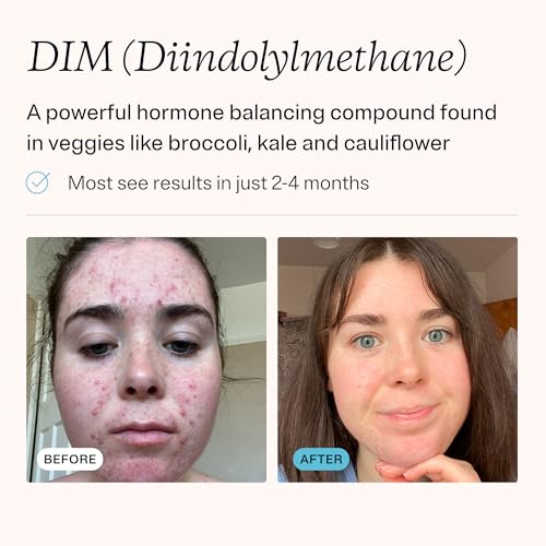 MDacne DIM Skin Clearing Supplements (30 Vegan Capsules) - for Acne Treatment, Estrogen Balance, Hormone Menopause Relief & Bodybuilding, Cruciferous Extract & Bioperine (30 Count (Pack of 1)) - Image 4