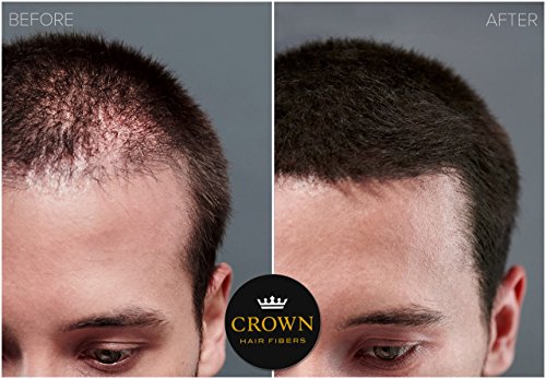 Crown Hair Fibers Crown Hair Building Fibers For Fine & Thinning Hair thumb #2