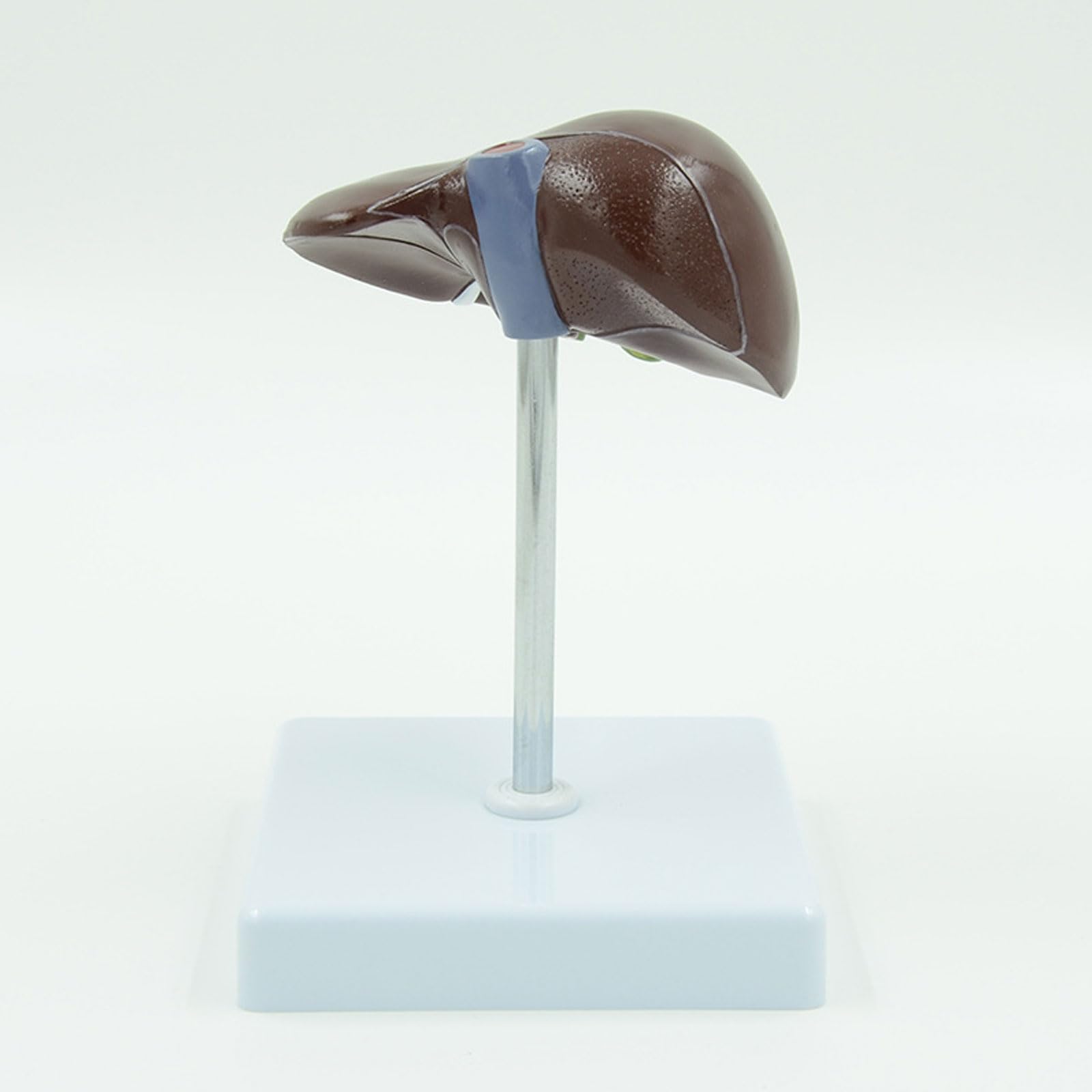 BYERZ Modèle Pathologique du Foie en 2 Parties Modèle Anatomique du Foie Malade Sciences Médicales Matériel Pédagogique Ressource Didactique