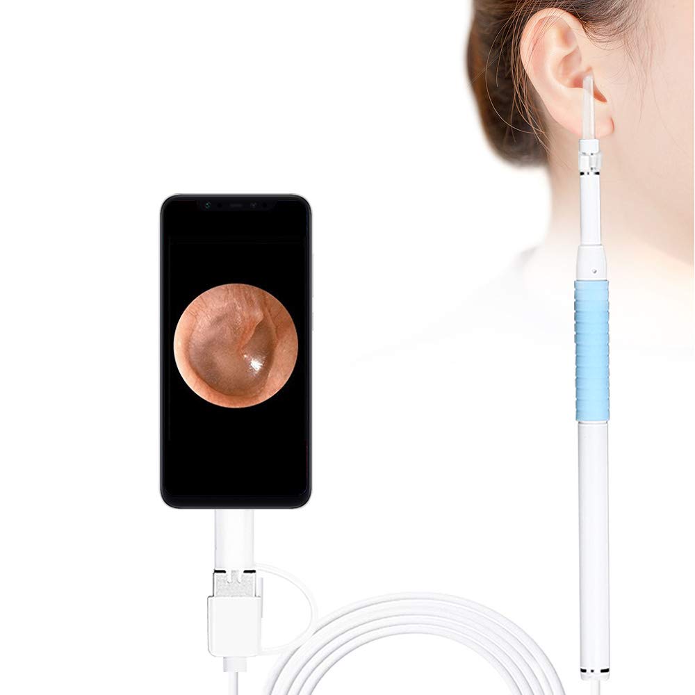 Buy URPIRE Oto Ear Cleaner 720P HD Digital Ear Camera USB Endo,3 in 1