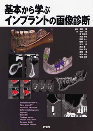 キンドル 無料電子書籍 基本から学ぶインプラントの画像診断 バイ