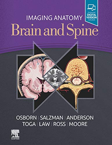 Imaging Anatomy Brain and Spine, E-Book Imaging Anatomy Brain and Spine, E-Book