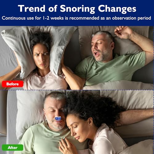 Anti Snoring Devices - Snoring Solution - Mini Anti Snoring Sleep Aid - Upgraded Variable Speed Mini Anti Snoring - Double Eddy Current Nasal Dilators - Blue