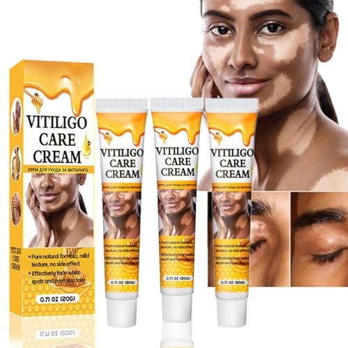 White 3pcs Weißer Fleck Creme,Vitiligo Creme,Vitiligo-Hautpflegebalsam Vitiligo-Creme,Vitiligo-Creme Für Weiße Flecken,Repigmentierungscreme Für Weiße Hautflecken Und Vitiligo