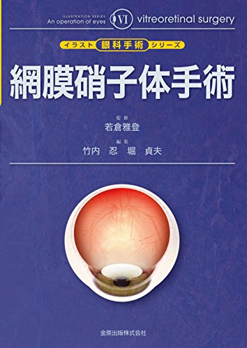 キンドル 無料電子書籍 網膜硝子体手術 (イラスト眼科手術シリーズ 6) バイ