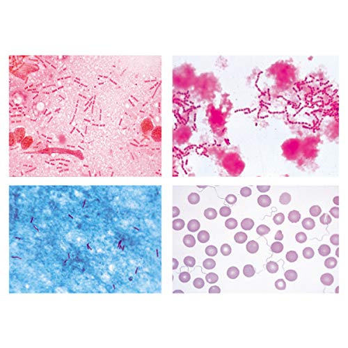 Image of 3B Scientific GmbH W13324 Pathogenic Bacteria-German