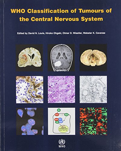 Who Classification of Tumours of the Central Nervous System (Who ...
