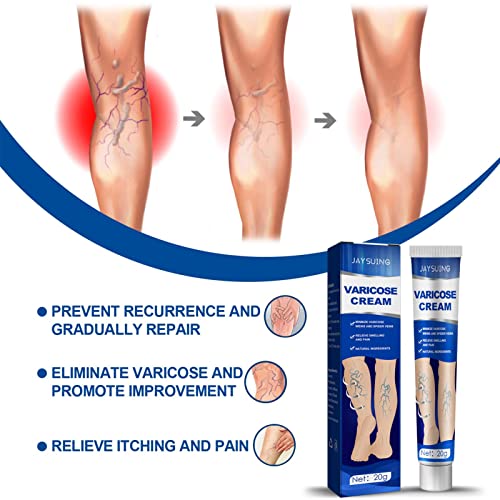 Creme de Cuidado de Veias, Cura eficaz de varizes e vasinhos, Alívio da inflamação da flebite e angi