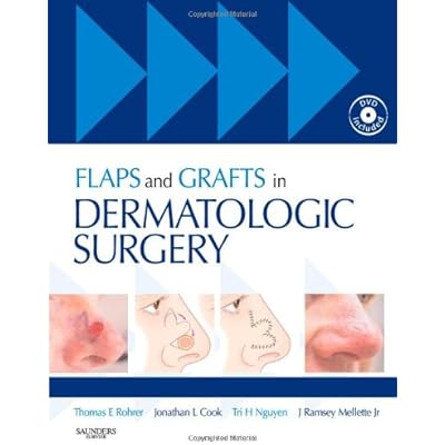Flaps and Grafts in Dermatologic Surgery