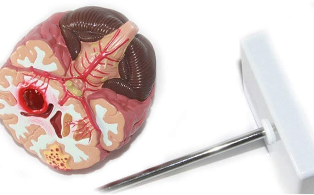 Tryb Nauczania Anatomii, Tryb Montażu Chorób Mózgu Ludzkiego, Tryb Anatomii Neurochirurgii, Tryb Nauczania Patologii Krwotoków Mózgowych