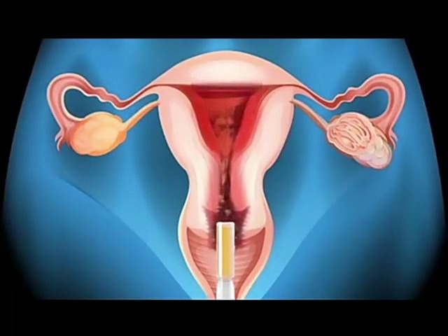 Amazon.com: Yoni Liquibeads for Women, Vaginal Moisturizer, Silicone-Base  Lube Helps Tightening Instantly : Health & Household
