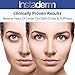 Instaderm Vitamin K Cream- Bruise Healing Formula with Arnica. Dark Spot Moisturizer for Bruising, Spider Veins & Broken Capillaries. Repair Under Eye Dark Circles, & Puffiness.