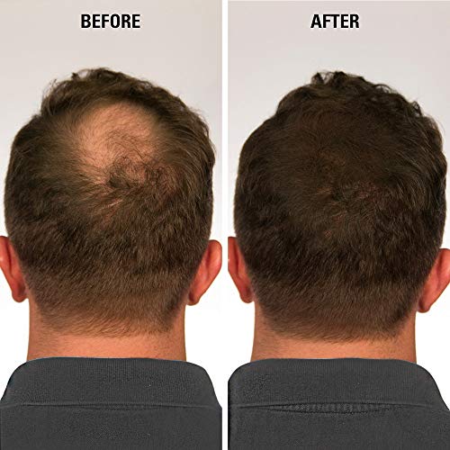 Ustar Hair building Fibers Hair Loss Concealer for Thinning Hair Light BlondE 0.42oz 12g - Thumbnail 5