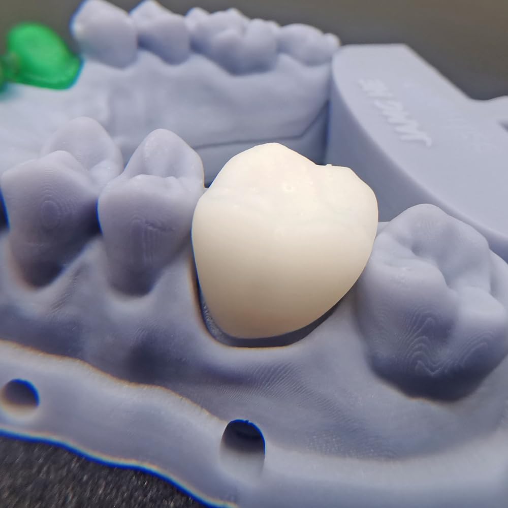 FDA Certification Temporary Dental Model A1 Resin, JAMG HE 405nm 3D Printer Temporary Dental Resin for DLP LCD High Precision High Hardness Fast Cure Teeth Appearance Color A1 500g