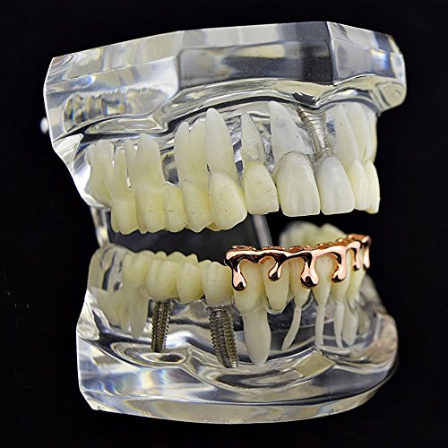 14K Rose Gold Plated Drip Grillz Dripping Slugs Bottom Row Hip Hop Teeth Grills #TOP25
