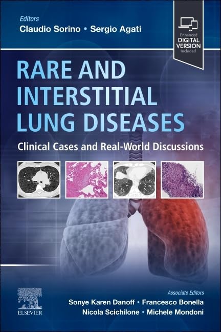 Interstitial Lung Disease
