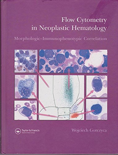 Flow Cytometry In Neoplastic Hematology: Morphologic--Immunophenotypic Correlation view 2