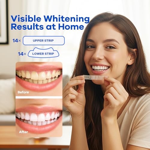 Berlix Teeth Whitening Strips (16 Treatments, 32 Count), Enamel Safe for Teeth Whitener, Whitening Strips with Coconut Oil, Formulated to Be Gentle & Non Slip and Quick-Dry, Stains Removal - Thumbnail 5