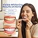 Berlix Teeth Whitening Strips (16 Treatments, 32 Count), Enamel Safe for Teeth Whitener, Whitening Strips with Coconut Oil, Formulated to Be Gentle & Non Slip and Quick-Dry, Stains Removal