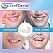 The ConfiDental Mouth Guard for Grinding Teeth at Night - 2 Models for Child or Small Mouth Pack of 6 Moldable Dental Night Guards for Teeth Grinding and Clenching Teeth Grinding Mouth Guard for Sleep