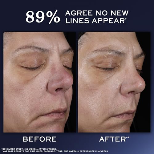 Lancôme Génifique Ultimate Dual Recovery Face Serum- Anti-Aging Serum Visibly Improves Fine Lines, Rough Texture, Plumpness and Even Skintone - with Beta Glucan and, Hyaluronic Acid - Image 4