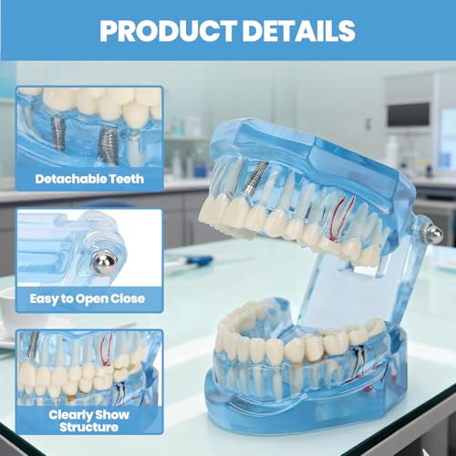 NSXAYIWE Zahnärztliches Oral-Typodont-Modell, Acryl-Blau-Zahnmodelle, Transparentes Mundmodell, Zahnmodell, Kompatibel Für Zahnmedizinisches Studium, Lehre, Forschung