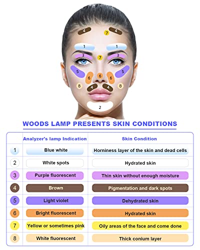 Eagou Diary Portable Woods Lamp Skin Analyzer Professional Facial Magnifying Analyzer Rechargeable Skin Detector For Spa Salon Home Skin Care Machine #TOP5