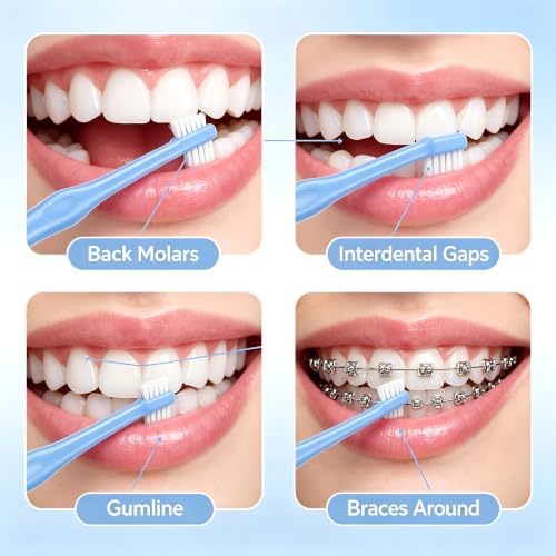 ZMoal Orthodontic Tufted Interproximal Tufted End Tuft Single Compact Interdental for Detail Cleaning Tapered (Tapered) 6Pcs - 5