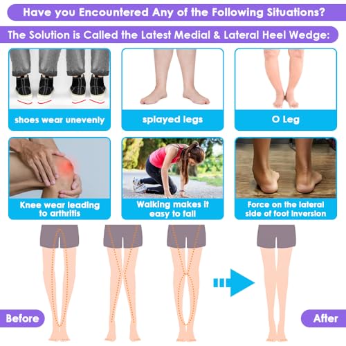 Svowin 3 Layers Adjustable Supination Overpronation Insoles thumb #1