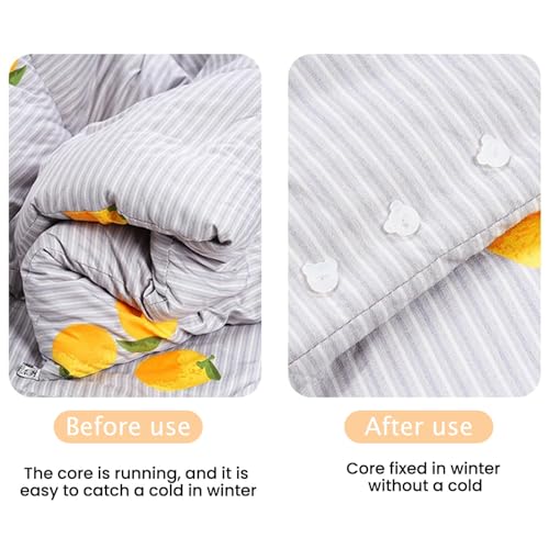 SSKHE Quick Clothing Fixer Kit, Micro Stitch Portable Gun for Clothes And Quilt Sewing, Mini Label Sewing Quilting Hemming Tool with 1100 Mini Micro Fasteners And 150Pcs Replaceable Bear Buttons