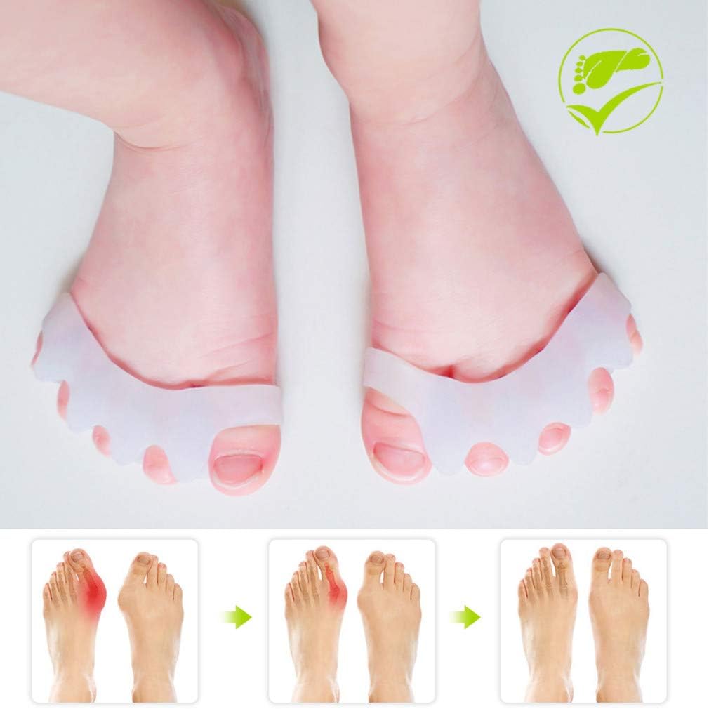 GloDeals Bunion Corrector Kids Toe Separator, 6 PCS Kids Toe Separator Soft Gel Bunion Pad&Spacer Kit Bunion Cushions Drift Pain Pads for Feet Overlapping Hallux Valgus (3-6 Years Old)