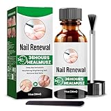 Toenail Treatment Extra Strength, Upgraded Toe Nail Treatments,Nail Treatment, Toe Treatment for Toenail, Safely and Gently (1 Fl Oz(Pack of 1))