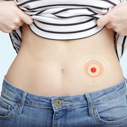 TNTNDAY 20PCS Ostomy Barrier Strips, Medical Grade Hydrocolloid, Ostomy Supplies, Elastic Barrier Adhesive Tape for Colostomy Bags, Urostomy Bag, Ileostomy Bag