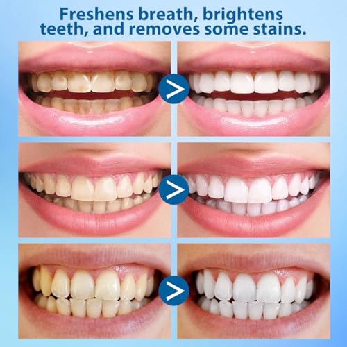 Poudre Blanchissante Dents 50g - image 6