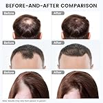 Red Light Therapy for Hair Growth: Cordless Red Light Heating Cap with 2000mAh Rechargeable Battery, Portable Care Tool for Home Use for Men & Women - Image 2