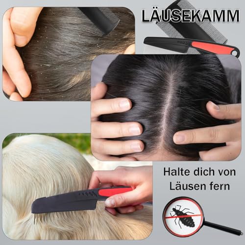 CONJURAIDE 4 Stück Läusekamm, Schuppenkamm Flohkamm Hunde Nissenkamm Dandruff Lice Comb Schuppen Haustier Kamm Hundekamm Schorfkamm Erwachsene Schuppenkamm Katzenkamm für Menschen Katzen