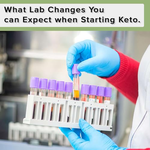What Lab Changes You can Expect when Starting Keto.