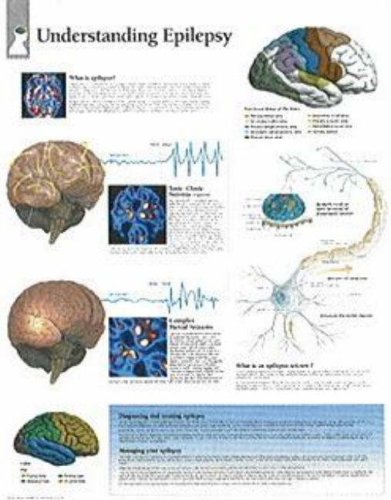 Understanding Epilepsy chart: Wall Chart