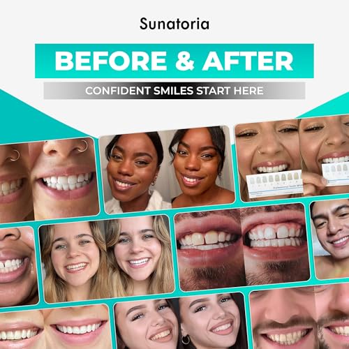 Image of Teeth Whitening Powder - Remineralizing Tooth Powder with Nano Hydroxyapatite, Charcoal + Bentonite & Kaolin Clays - Gentle Tooth Polish for Sensitive Teeth, Fluoride-Free, Mint, 2 oz