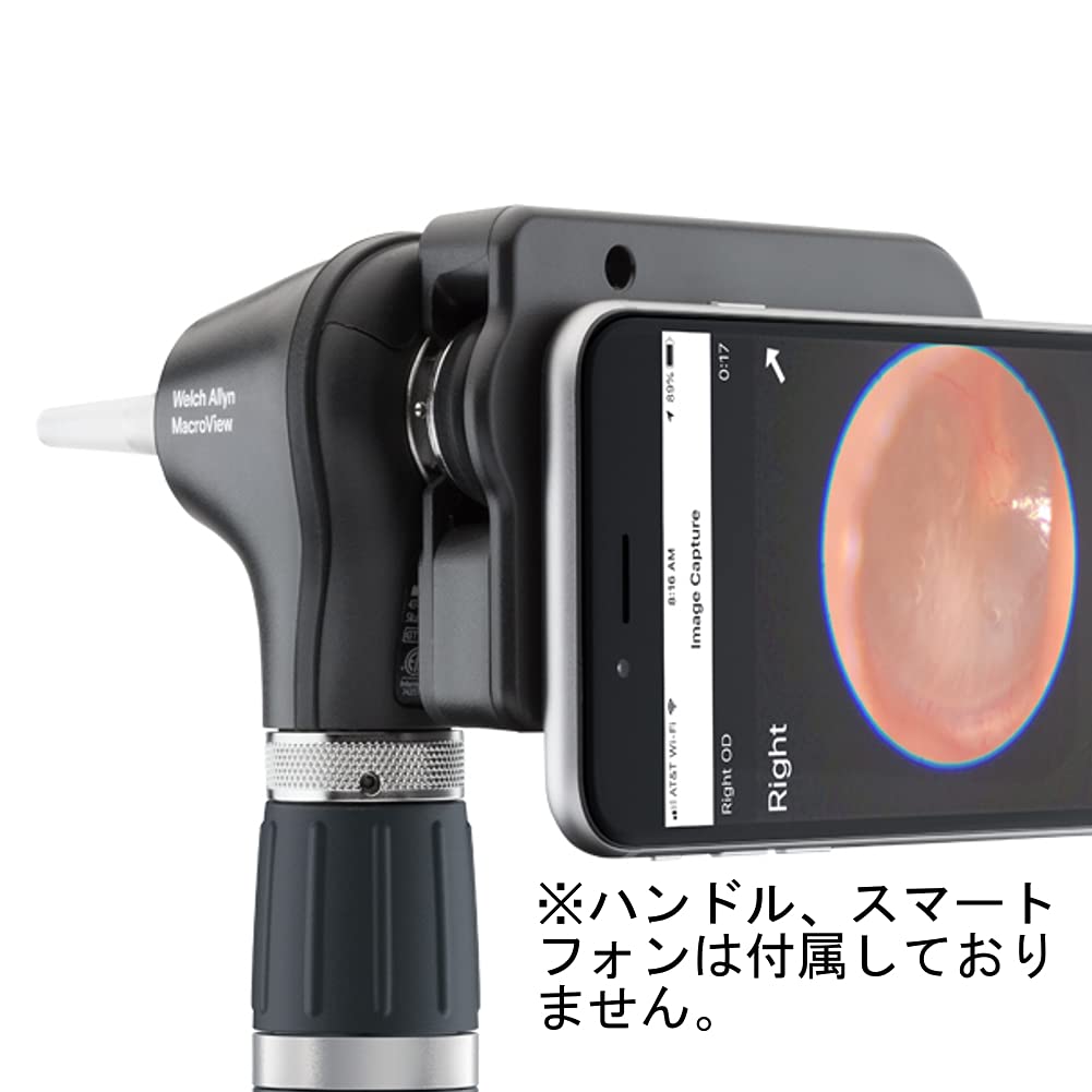 Amazon.co.jp: ウェルチアレン 耳鏡 マクロビュー プラス iExaminer